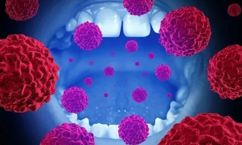 Có 2 dấu hiệu này, người đàn ông 60 tuổi sốc khi phát hiện mắc 2 loại ung thư